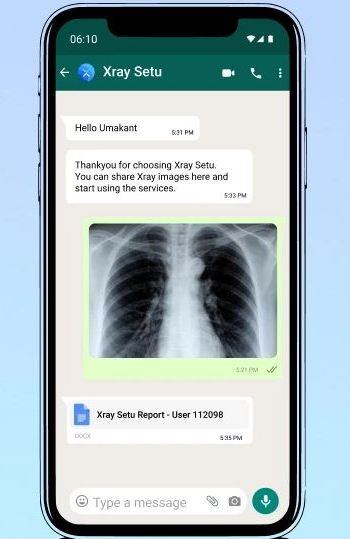AI-based Solution XraySetu Launched to Detect Covid in Rural Population via WhatsApp