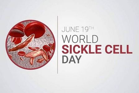 World Sickle Cell Day: 19 June